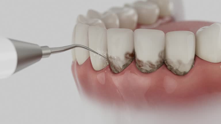Trusted Emergency Dentist service in Gambier, OH - Dentist Open Now